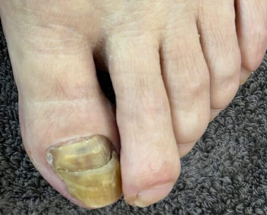 1年って長い？短い？1年でどう変わる？