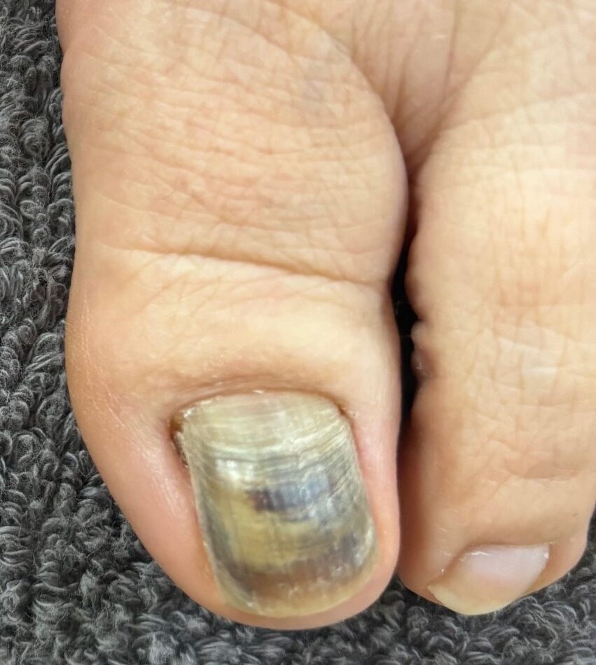 そのうち取れるって…いつ取れる？もっと酷くなったら？