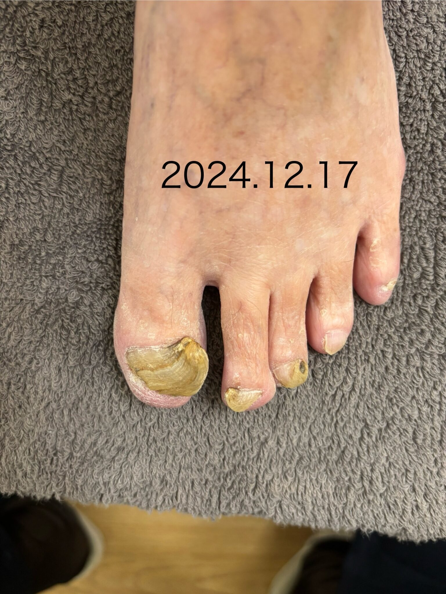 わしの爪、もともとこんなんじゃった！